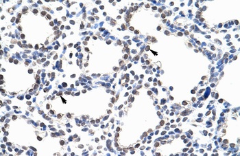 KIAA0020 Antibody