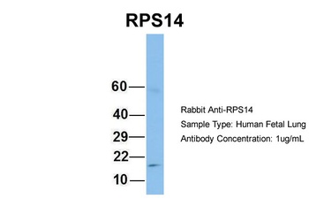 RPS14 Antibody