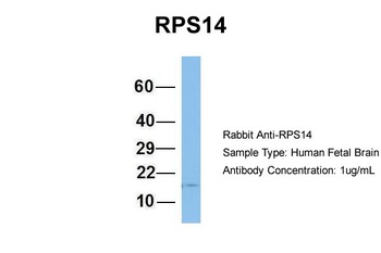 RPS14 Antibody