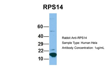 RPS14 Antibody