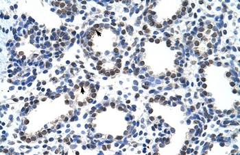 CARS Antibody