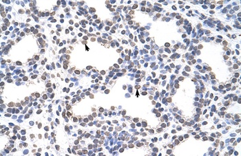 CARS Antibody