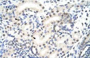 SNRNP70 Antibody