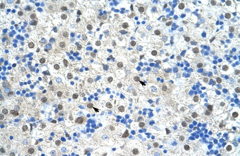 SF3B1 Antibody