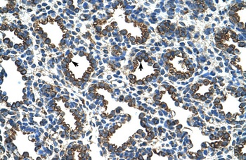 RPL8 Antibody