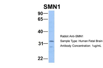 SMN1 Antibody