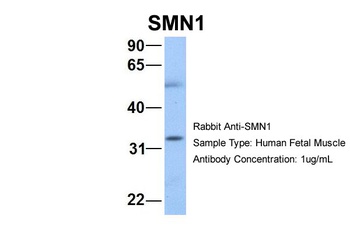 SMN1 Antibody