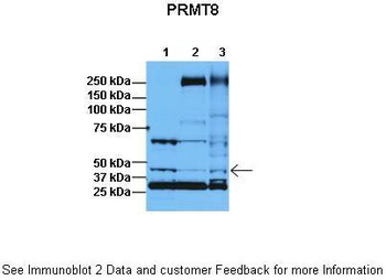 PRMT8 Antibody
