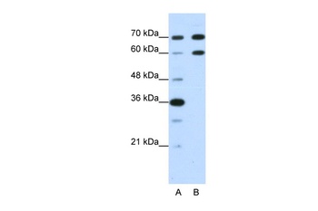 DMRT2 Antibody