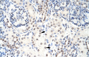 HKR1 Antibody