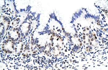 ZNF296 Antibody
