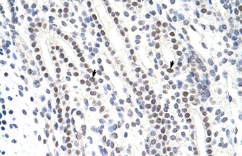 ZNF296 Antibody
