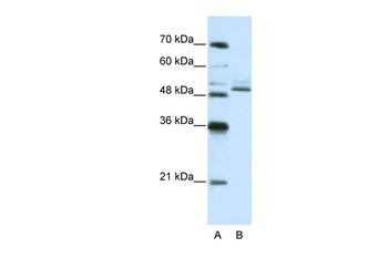 ZNF296 Antibody