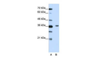 BTBD6 Antibody
