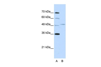 FOXQ1 Antibody