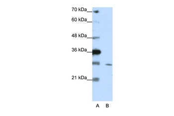 ZNF397 Antibody