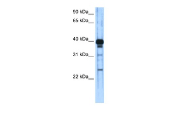 ZSCAN16 Antibody