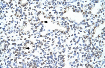 POGZ Antibody