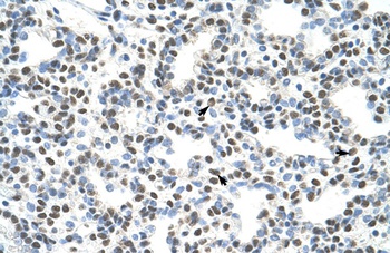 AKAP8L Antibody