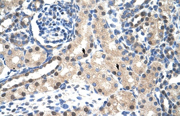 STAT1 Antibody