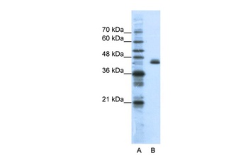 ZFP36L2 Antibody