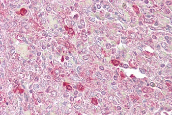 ATF1 Antibody