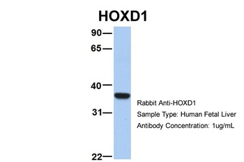 ETV5 Antibody