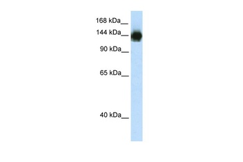 TIMELESS Antibody