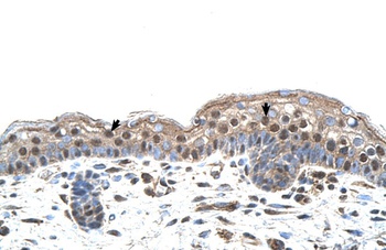 IRF4 Antibody