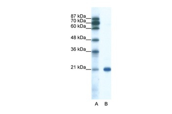 SSX2 Antibody
