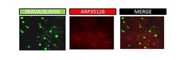 KCNAB2 Antibody