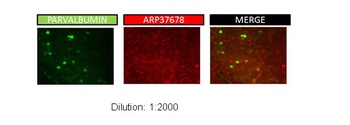 KCNAB2 Antibody