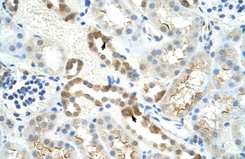 MYBBP1A Antibody