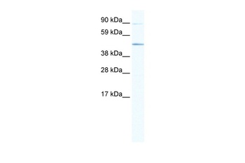 Ecsit Antibody