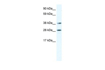MEF2B Antibody