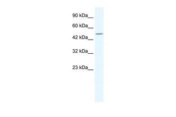 TPTE Antibody