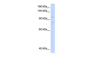 MCM8 Antibody