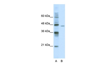 DDX25 Antibody