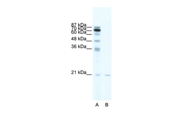SCAND1 Antibody