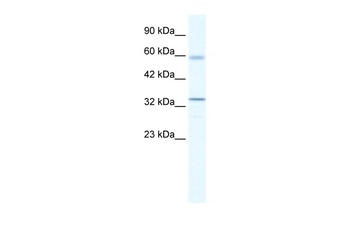 ZBTB7A Antibody