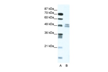 TRIP13 Antibody