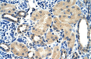 AIP Antibody