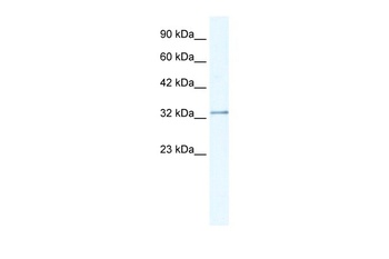 NUDT9 Antibody