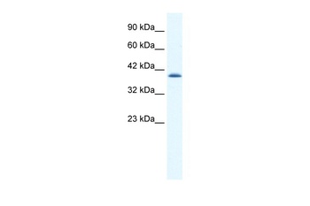 CATSPER2 Antibody