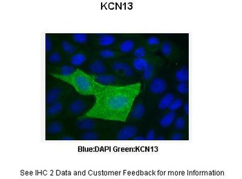 KCNK13 Antibody