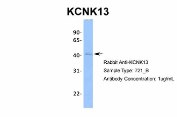 KCNK13 Antibody