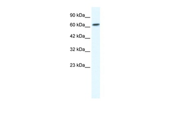 GABRB2 Antibody