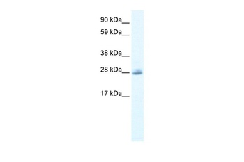 CLIC5 Antibody