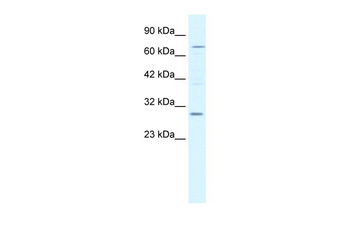 KCNIP1 Antibody