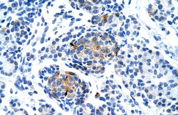 P2RX1 Antibody